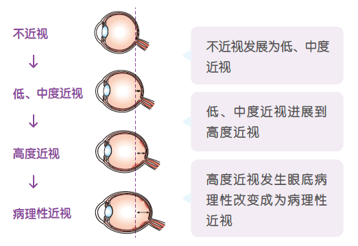 3-18岁儿童青少年该如何护眼？官方建议来了！